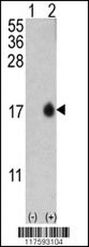 LC3 Antibody (APG8B) (T6)
