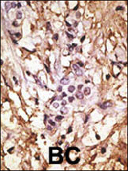 LC3 Antibody (APG8B) (C-term)