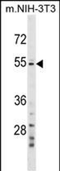 GPT2 Antibody (N-term)