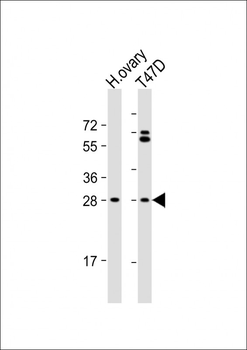 FIGLA Antibody (Center)
