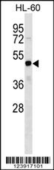 FEZF2 Antibody (Center)