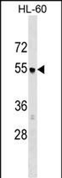AP3M1 Antibody (C-term)