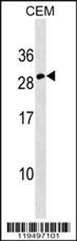 Erythropoietin Antibody (C-term)