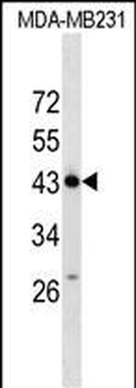 ZNF550 Antibody (N-term)