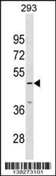 IP6K3 Antibody (N-term)
