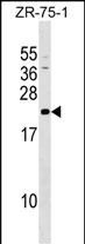 GRPEL1 Antibody (Center)