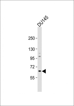 GALNT9 Antibody (Center)
