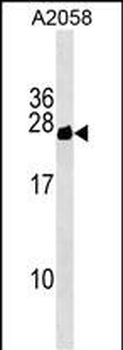 CYorf15B Antibody (Center)