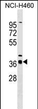 SERTAD2 Antibody (N-term)