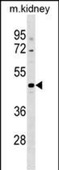 CCDC91 Antibody (C-term)