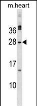 MSC Antibody (C-term)