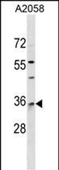 RAB40A Antibody (Center)