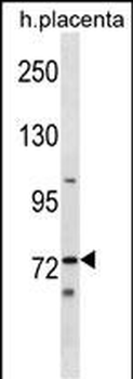Mouse Sgk071 Antibody (N-term)