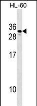 CGB2 Antibody (N-term)