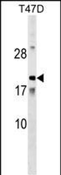 AMTN Antibody (N-term)