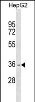 DHRS1 Antibody (Center)