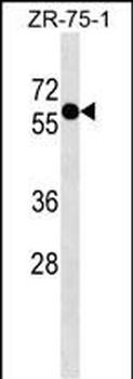 ZNF503 Antibody (N-term)
