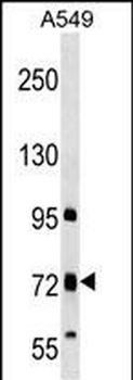 TMC4 Antibody (N-term)