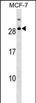 RNASE11 Antibody (Center)