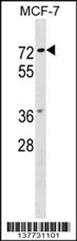 NOTUM Antibody (C-term)