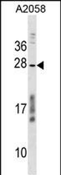 CCDC144NL Antibody (C-term)