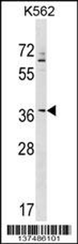 ZNF385A Antibody (N-term)