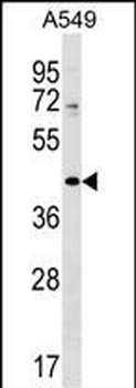 ZNF25 Antibody (N-term)
