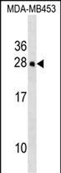 Mouse Hoxc5 Antibody (C-term)