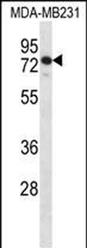 SLFN12 Antibody (Center)
