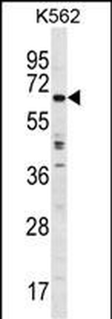 TRIM75 Antibody (Center)