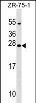 NXNL1 Antibody (Center)
