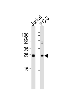 HMGB4 Antibody (Center)
