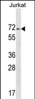 ZNF613 Antibody (C-term)