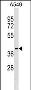 ZCCHC12 Antibody (C-term)