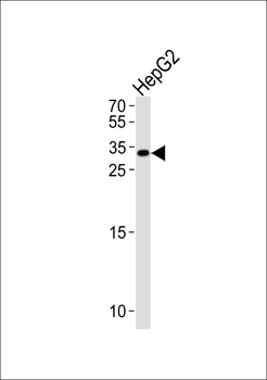 NKX6-3 Antibody (Center)