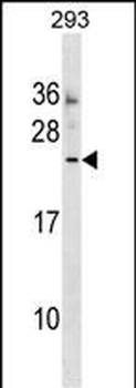 MOSPD3 Antibody (Center)