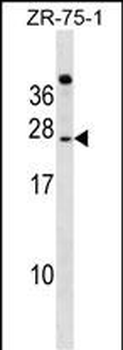 IGSF6 Antibody (Center)