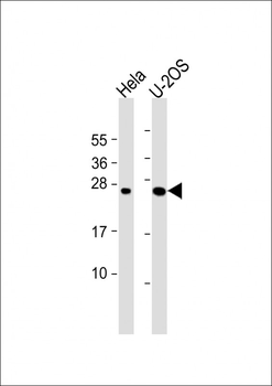 DCTN6 Antibody (Center)