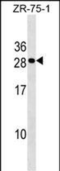 CLEC9A Antibody (Center)