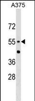 CNDP1 Antibody (Center)