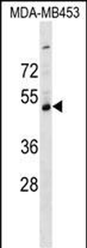 SERPINI2 Antibody (C-term)