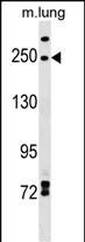 INF2 Antibody (Center)