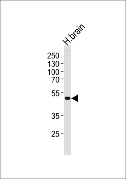 KCNJ12 Antibody (C-term)