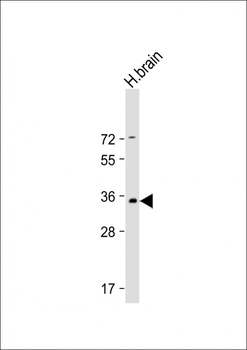 PRRT2 Antibody (Center)