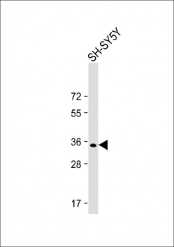 PRRT2 Antibody (Center)