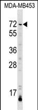 AMIGO3 Antibody (Center)