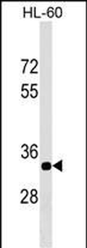 ERAL1 Antibody (Center)
