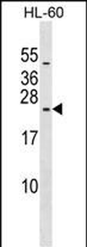RPL10L Antibody (N-term)