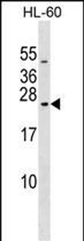 RAB20 Antibody (C-term)