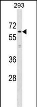 KLHL2 Antibody (N-term)